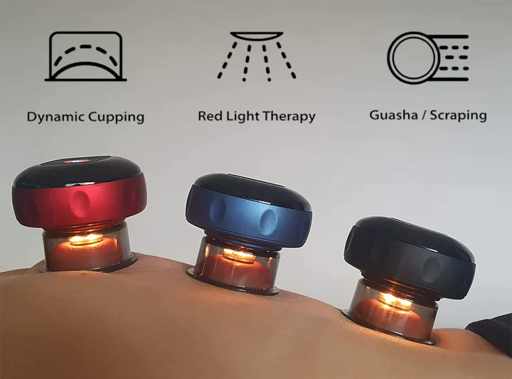 Cupping Therapy SmartCup