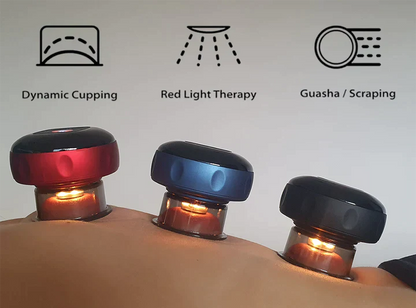Cupping Therapy SmartCup